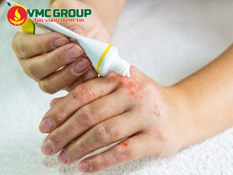 Ứng dụng trong ngành dược phẩm
